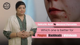 Salicylic Acid vs Benzoyl Peroxide  Get Rid of Pimples Blackheads amp Whiteheads  Dr Nivedita Dadu [upl. by Elyac159]