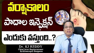 Kj reddy About Infections Of Heel  How to Cure Heel Pain in Telugu  Causes of Heel Pain [upl. by Esele]