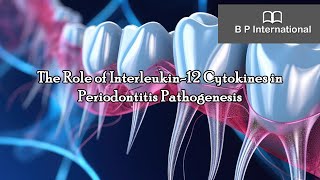 The Role of Interleukin12 Cytokines in Periodontitis Pathogenesis [upl. by Nlocnil]