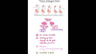 TracheoEsophageal fistula [upl. by Boykins]