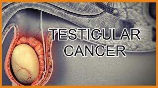 Testicular CancerTumors [upl. by Sheree]