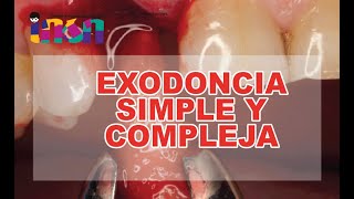 Exodoncia Simple y Compleja  Telecapacitación INSN [upl. by Motch]