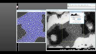 How to use ImageJ for nanoparticle size distribution analysis [upl. by Yhtir]