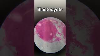 TS of ovary  TS of testis  ringworm bacteria under microscope biology animalkingdomclass11 [upl. by Creigh620]