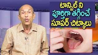 Best Home Remedy For Tonsillitis in Telugu  Tonsillitis Treatment  Telugu Home Tips  Great Health [upl. by Finah]