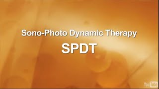 SonoDynamic Therapy for Cancer Treatment [upl. by Socem]