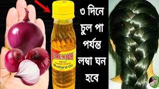 ৩ দিন এটা লাগাও চুল পড়া বন্ধ হবে চুল ঘন লম্বা কালো হবে নতুন চুল গজাবেhair growth remedies [upl. by Acinehs]