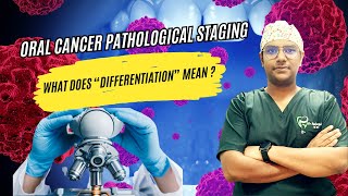 Dr Rudra Mohan Histopathological Staging  Differentiation Of Oral Cancer  Simplified at a glance [upl. by Yruam]