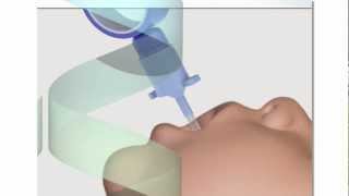 Neonatal Endotracheal Intubation [upl. by Dloreh]