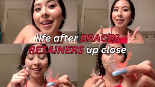 Life After Braces Wearing RETAINERS update  vlog [upl. by Mayman]