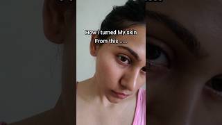 This SKINCARE SECRET really WORKS💯 skincare skincaretips [upl. by Nirmak]