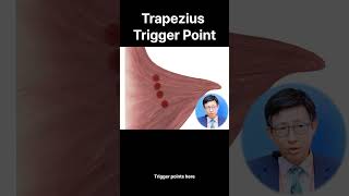 Trigger Point amp Myofascial Pain Syndrome Treatment at Home [upl. by Dale]