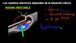 CURSO DE EKG 32  ELECTROCARDIOGRAFÍA DE LA CARDIOPATÍA ISQUÉMICA  INTRODUCCIÓN CLÍNICA [upl. by Nirtiac]