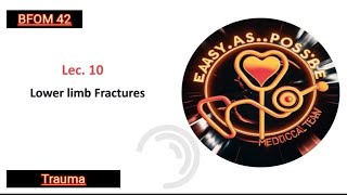 Lecture 10  Lower Limb Fractures  Trauma 42 [upl. by Eiramannod]