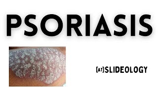 The True Cause of Psoriasis and How to Heal It [upl. by Oznohpla]