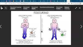 Decorticate and Decerebrate posturingNCLEX Exam Nursing Medical Student [upl. by Enyak]