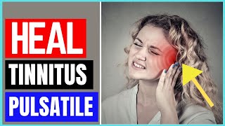 How To Get Rid Of Pulsatile Tinnitus [upl. by Claudia]