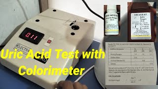 Uric Acid Test Procedure ।। Uric Acid Test with Colorimeter  practical  In Hindi uricacid [upl. by Renwick94]