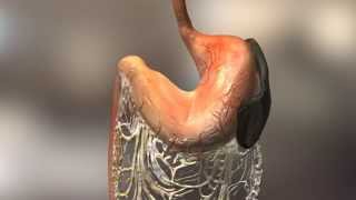 Patterson Veterinary DIA Client Education Video Gastric DilatationVolvulus GDV Bloat [upl. by Sinai]