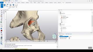 Automatic Acetabular Cup Placement Script [upl. by Eat292]