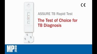 ASSURE TB Rapid Test [upl. by Latsyrc]