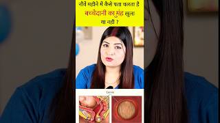 9वें महीने में खुलने लगा है बच्चेदानी का मुंह l Symptoms of Cervix Opening shorts pregnancy [upl. by Ohara224]