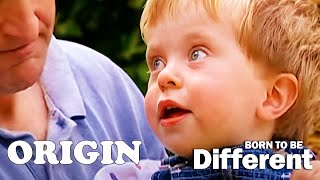 The Children Living With Dwarfism  Born To Be Different  Part 2  Origin [upl. by Fesuoy805]