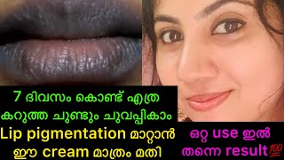 കരികട്ട ചുണ്ടും ചുമക്കാൻ ഒരു ദിവസം മതി 💯live result lipcarelippigmentation [upl. by Englebert]