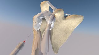 Anatomic Model of a Bicipital Sheath Injection by probeultrasound [upl. by Nanyt762]