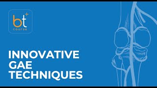 Case Discussion Innovative Genicular Artery Embolization Techniques Two Case Studies [upl. by Drandell]