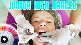 THIRTEEN YEAR OLD GETTING BRACES TIGHTENED FOR THE FIRST TIME  CHANGING BRACES RUBBER BANDS COLOR [upl. by Blood]