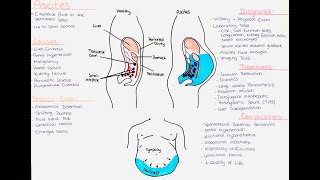 Ascites  Causes Diagnostic Algorithm Treatment Complications [upl. by Odelle182]