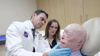 Face transplant recipient speaks one year after surgery [upl. by Gilbert]