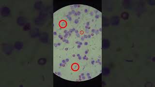 How To Read A Skin Cytology Slide shorts [upl. by Haff805]