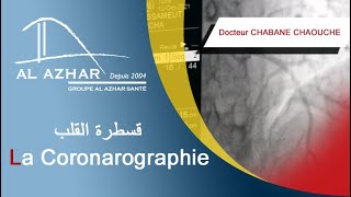 La Coronarographie قسطرة القلب [upl. by Ayetal]