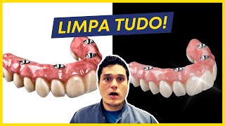 Aprenda a LIMPAR sua PRÓTESE FIXA PROTOCOLO do Jeito Certo [upl. by Kirkwood568]