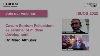 ISUOG 2022 Webinar  Cavum Septum Pellucidum as sentinel of midline development Dr Marc Althuser [upl. by Nallak]