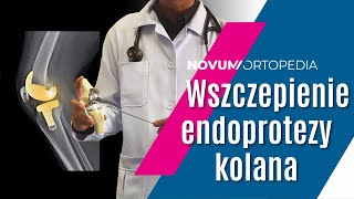 Obustronna ALLOPLASTYKA KOLAN  zabieg WSZCZEPIENIA ENDOPROTEZY stawu kolanowego  Novum Ortopedia [upl. by Amlev]