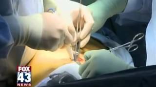 Video Assisted Thoracic Surgery [upl. by Gilcrest414]