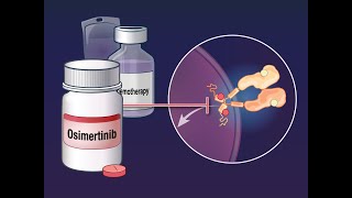 Osimertinib with Chemotherapy in EGFRMutated NSCLC  NEJM [upl. by Enowtna]