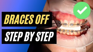 BRACES OFF  Step by step orthodontic removal [upl. by Asilanom622]