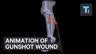 Animation of gunshot wound [upl. by Emile394]