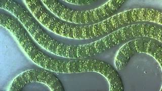 Cyanobacteria under microscope [upl. by Ahsie]