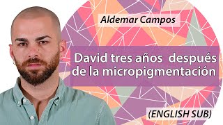 👉❗INCREÍBLE❗ David 3 años después de la micropigmentación capilar ENGLISH SUB [upl. by Seadon]