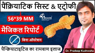 Atrophy Pancreatitis Treatment  Pseudocyst Pancreatitis treatment hindi  Best Pancreas treatment [upl. by Alac68]