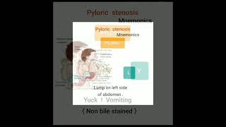 🦅 PYLORIC STENOSIS Mnemonic 🕊 [upl. by Lewak]