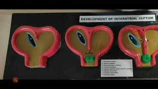 Development of interatrial septum exam model important [upl. by Hgalehs]