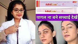 Skin Whitening HH Lite Skin Cream honest reviewHHLite cream benefits amp Sids effects review inhindi [upl. by Albin212]