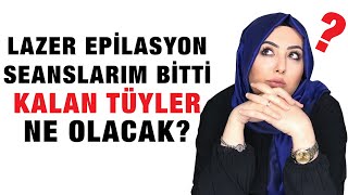 Lazer Epilasyon Seanslarım Bitti Kalan Tüyler İçin Ne Yapmalıyım [upl. by Alegnatal444]