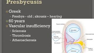 Presbycusis Made Easy  MBBS ENT Lectures [upl. by Ennalorac]